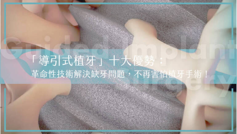 「導引式植牙」十大優勢：革命性技術解決缺牙問題，不再害怕植牙手術！