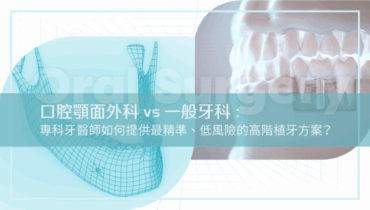口腔顎面外科 vs 一般牙科:專科牙醫師如何提供最精準、低風險的高階植牙方案?