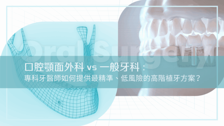 口腔顎面外科 vs 一般牙科：專科牙醫師如何提供最精準、低風險的高階植牙方案？