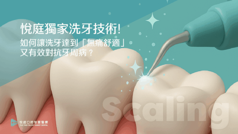 悅庭獨家洗牙技術！如何讓洗牙達到「無痛舒適」又有效對抗牙周病？