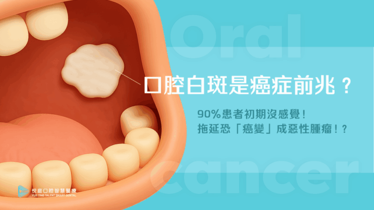 口腔白斑是癌症前兆？90%患者初期沒感覺！拖延恐「癌變」成惡性腫瘤！？