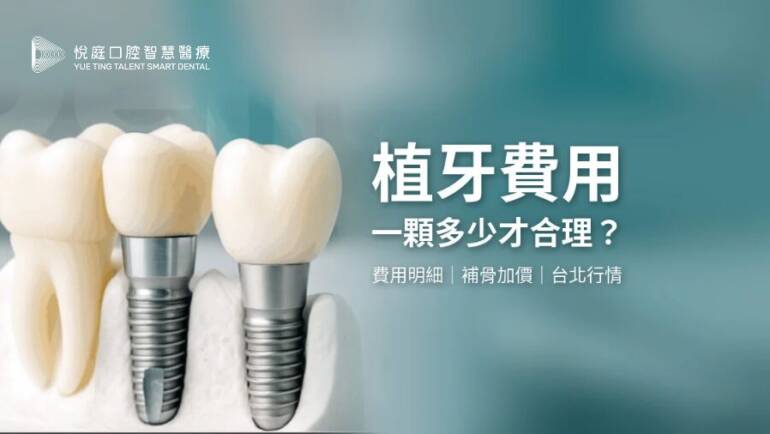 2026 植牙費用總整理：單顆價格、補骨試算與台北行情解析｜曹皓崴醫師實際經驗分享(2026.09更新)