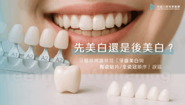 先美白還是後美白？牙醫師揭露常見「牙齒美白與陶瓷貼片/全瓷冠」順序誤區