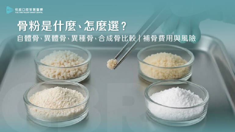 骨粉是什麼、怎麼選？自體骨、異體骨、異種骨、合成骨比較｜補骨費用與風險(2026.10更新)