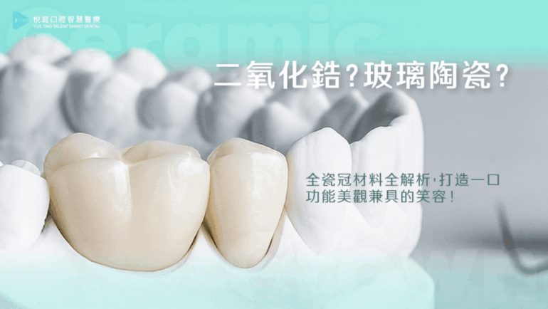 二氧化鋯？玻璃陶瓷？全瓷冠材料全解析，打造一口功能美觀兼具的笑容！
