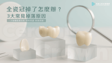 全瓷冠掉了怎麼辦？3大常見掉落原因，解析黏著技術、材料保證、術後保固！