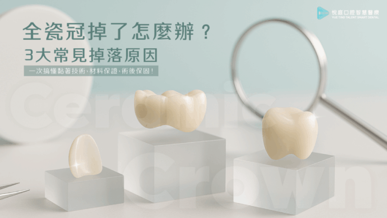 全瓷冠掉了怎麼辦？3大常見掉落原因，解析黏著技術、材料保證、術後保固！