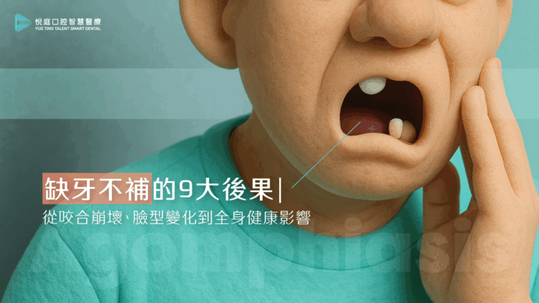 缺牙不補的 9 大後果｜從咬合崩壞、臉型變化到全身健康影響