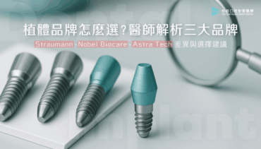 【2025植牙指南】植體品牌怎麼選？醫師解析三大品牌 Straumann、Nobel Biocare、Astra Tech 差異與選擇建議