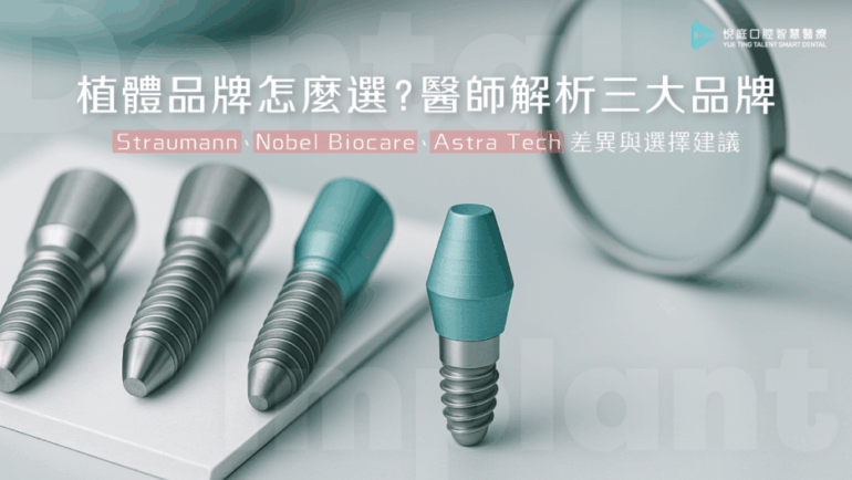 【2025植牙指南】植體品牌怎麼選？醫師解析三大品牌 Straumann、Nobel Biocare、Astra Tech 差異與選擇建議