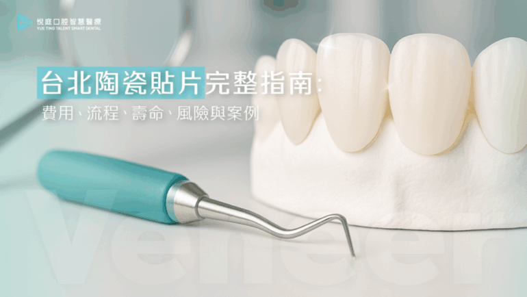 【2025台北陶瓷貼片完整指南】：費用、流程、壽命、風險與案例