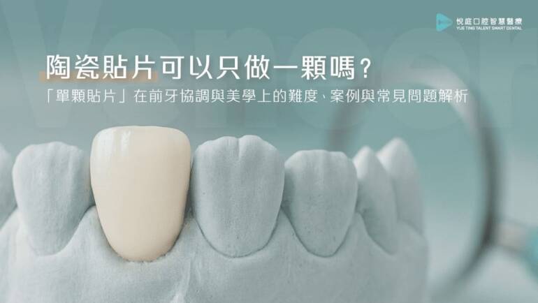 陶瓷貼片可以只做一顆嗎？「單顆貼片」在前牙協調與美學上的難度、案例與常見問題解析