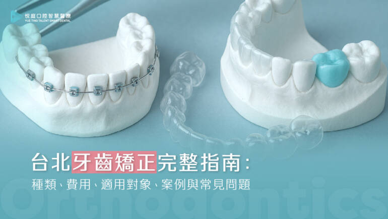 【2025台北牙齒矯正完整指南】：種類、費用、適用對象、案例與常見問題