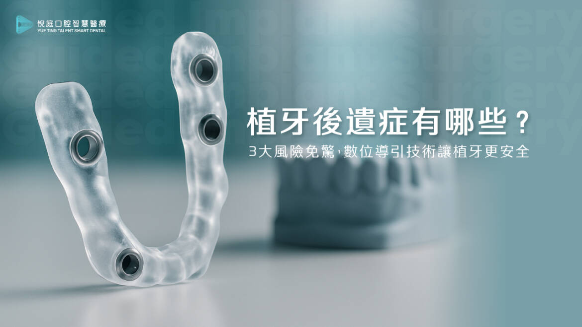 植牙後遺症有哪些？3 大風險免驚，數位導引技術讓植牙更安全