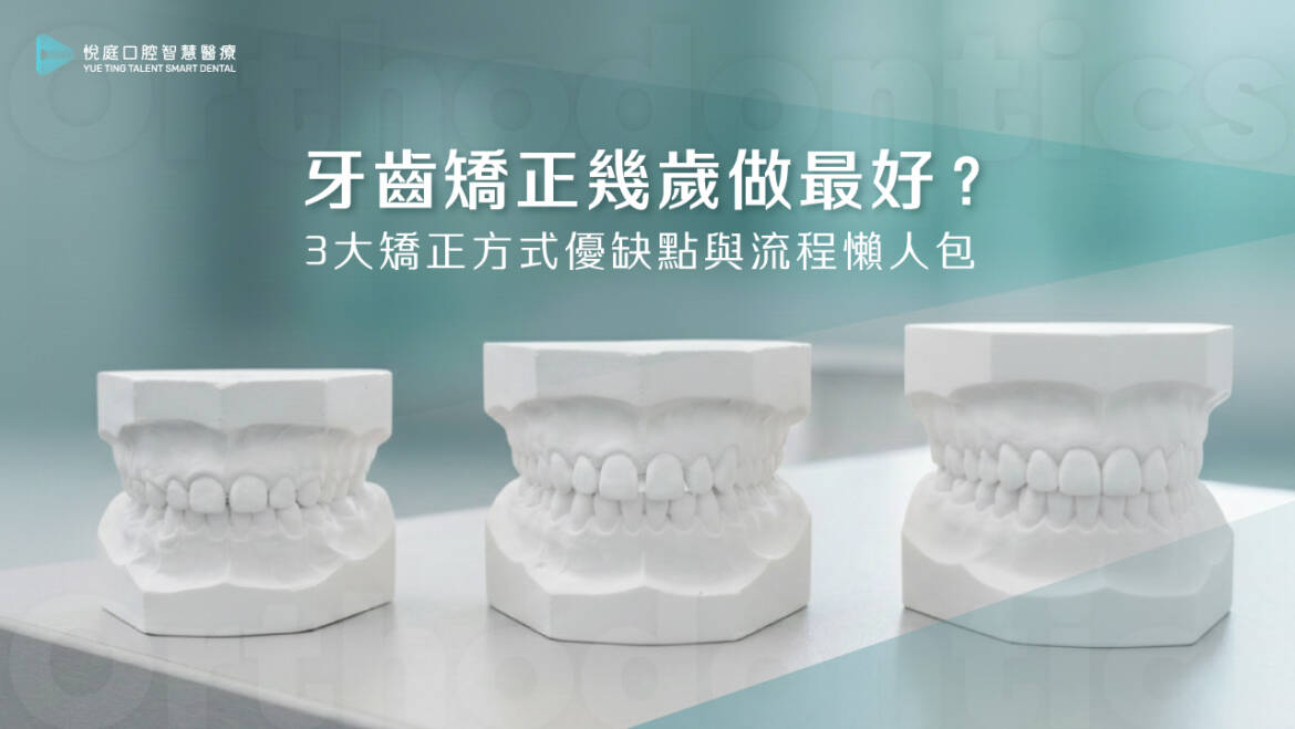 牙齒矯正幾歲做最好？3大矯正方式優缺點與流程懶人包