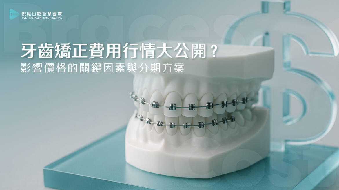 牙齒矯正費用 2025 行情大公開！影響價格的關鍵因素與分期方案