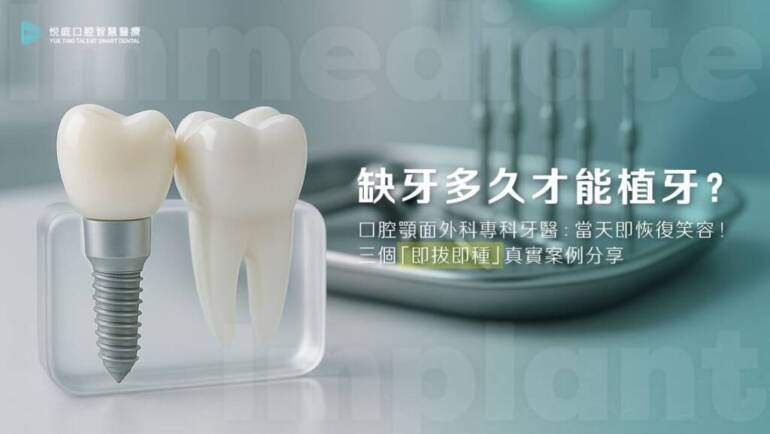 缺牙多久才能植牙？口腔顎面外科專科牙醫：當天即恢復笑容！三個「即拔即種」真實案例分享