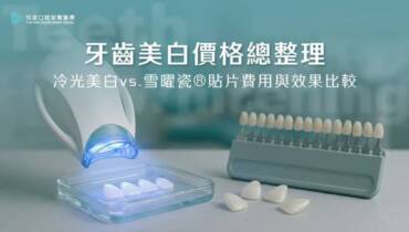 牙齒美白價格總整理｜冷光美白 vs. 雪曜瓷®貼片費用與效果比較