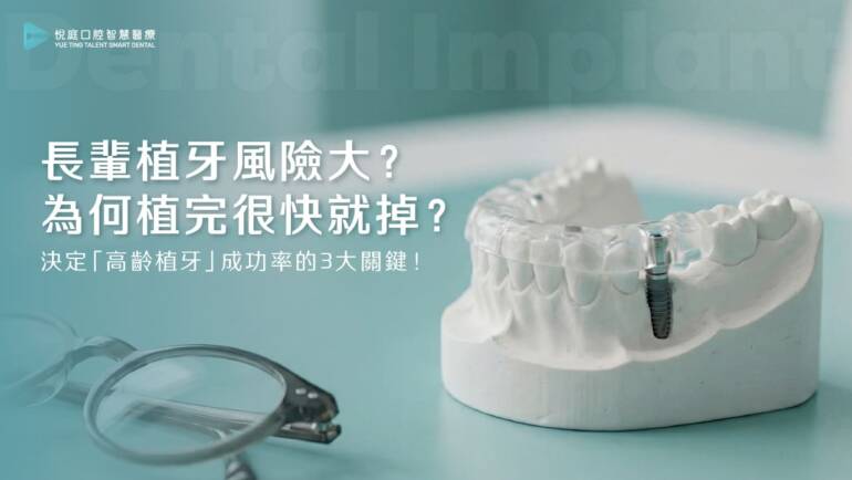長輩植牙風險大？為何植完很快就掉？決定「高齡植牙」成功率的 3 大關鍵！