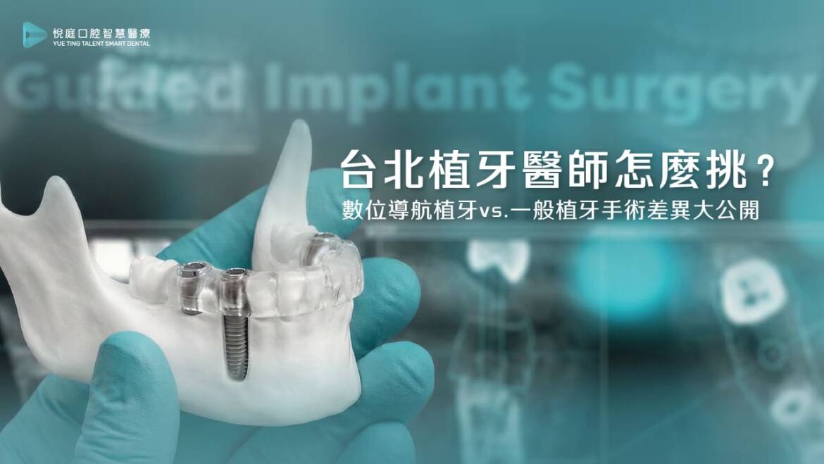 台北植牙診所怎麼選？從一位前牙崩壞重建的案例，了解「數位導航植牙」與一般植牙手術有什麼差異？