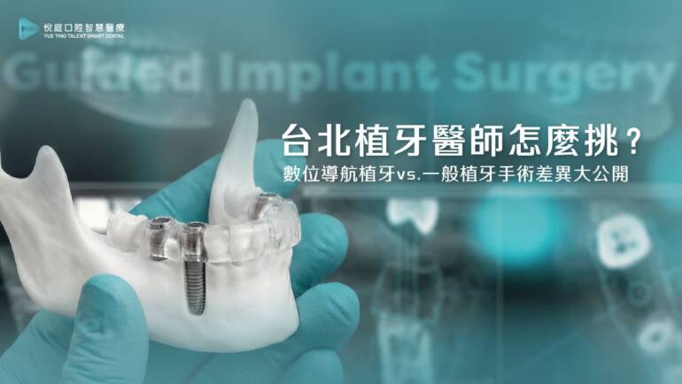 台北植牙診所怎麼選？從一位前牙崩壞重建的案例，了解「數位導航植牙」與一般植牙手術有什麼差異？