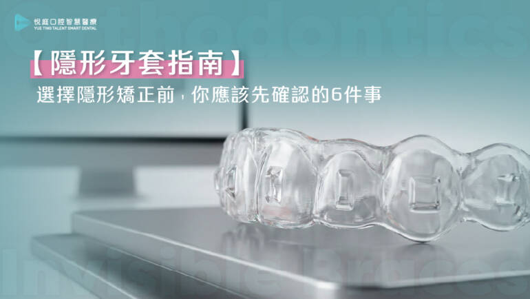 【2026隱形牙套指南】選擇隱形矯正前，你應該先確認的 6 件事