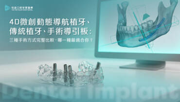4D微創動態導航植牙、傳統植牙、手術導引板：三種手術方式完整比較，哪一種最適合你？