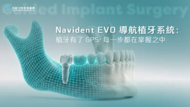 盲測植牙險斷神經、顏面麻痺？Navident EVO 導航植牙系統：植牙界的GPS，精準安全的微創植牙新選擇