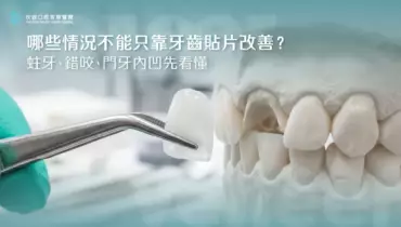 哪些情況不能只靠牙齒貼片改善？蛀牙、錯咬、門牙內凹先看懂