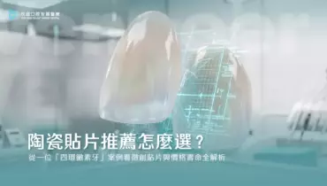 陶瓷貼片推薦怎麼選？從一位「四環黴素牙」案例看微創貼片與價格壽命全解析