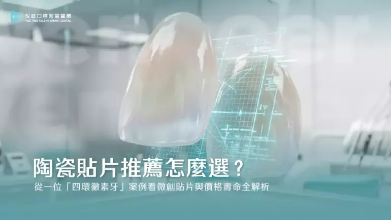 陶瓷貼片推薦怎麼選？從一位「四環黴素牙」案例看微創貼片與價格壽命全解析