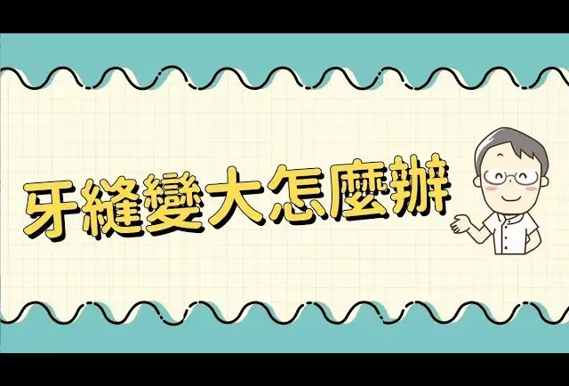 牙縫越來越大怎麼辦？-院長 曹皓崴醫師
