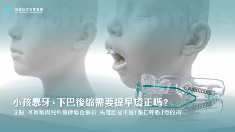 小孩暴牙、下巴後縮需要提早矯正嗎？牙醫、耳鼻喉與兒科醫師聯合解析：先確認是不是「張口呼吸」惹的禍